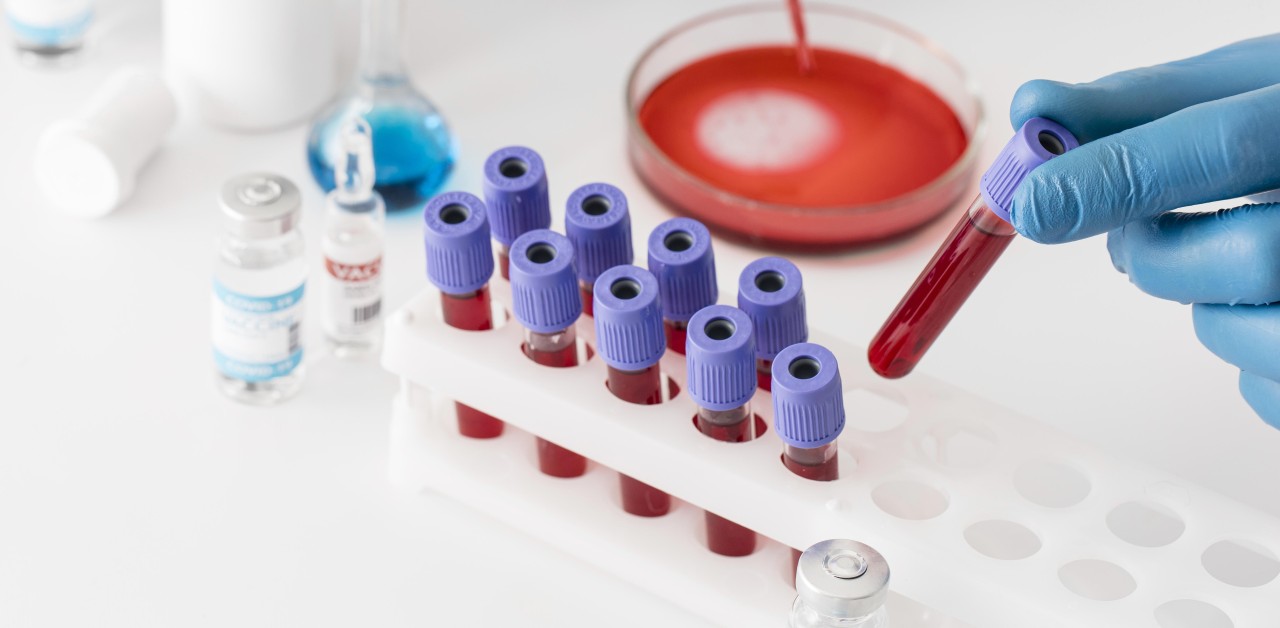 coronavirus-vaccine-lab-with-samples-1